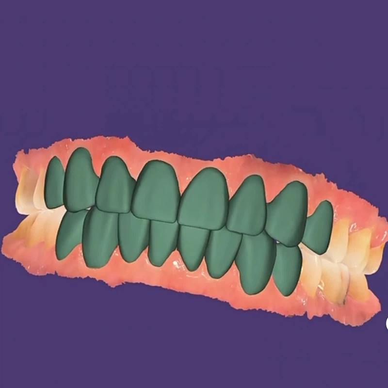 Dental 3D Printing Model Digital Design